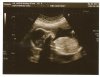 babyb2.jpg