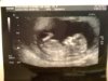 12 week scan.jpg