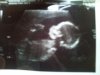 20 weeks 3.jpg