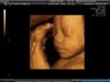 BABYBOND_9.JPG