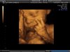 BABYBOND_17.JPG