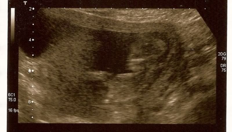 12WeekScan09-Jun-20091.jpg