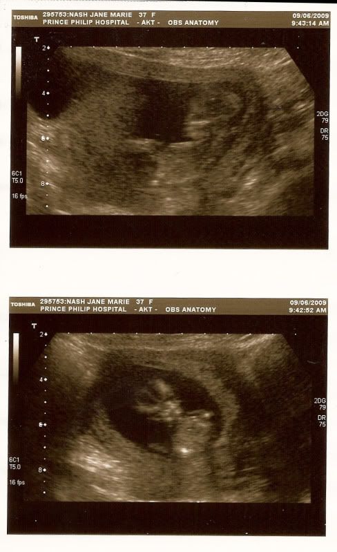 12WeekScan09-Jun-2009.jpg