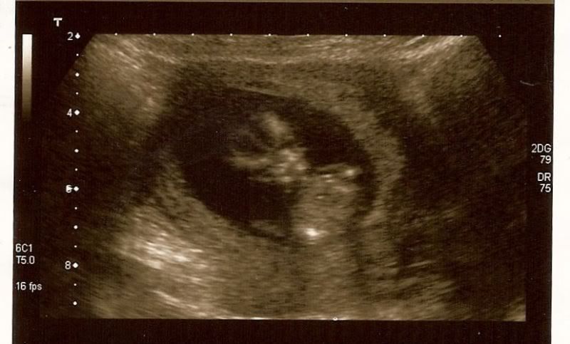 12WeekScan09-Jun-20092.jpg